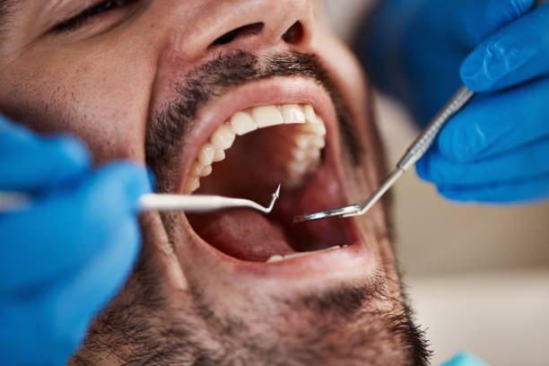 Best Urgent Care for Lost Fillings or Crowns in South Miami Heights, FL